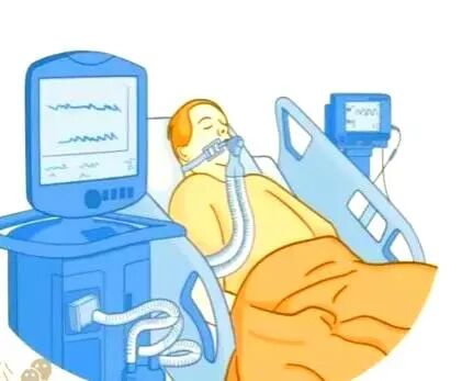 什么是有创呼吸机图片儿童ICU里的“呼吸外挂”哪家更强：经鼻高流量氧疗 vs 有创机械通气_https://www.jmylbn.com_新闻资讯_第7张