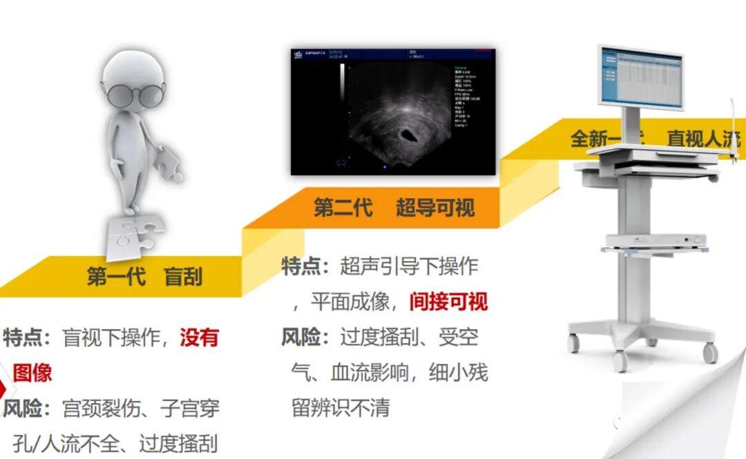 什么是宫腔组织吸引术【科普】宫腔直视人流术——因为看得见，所以更安全_https://www.jmylbn.com_新闻资讯_第5张