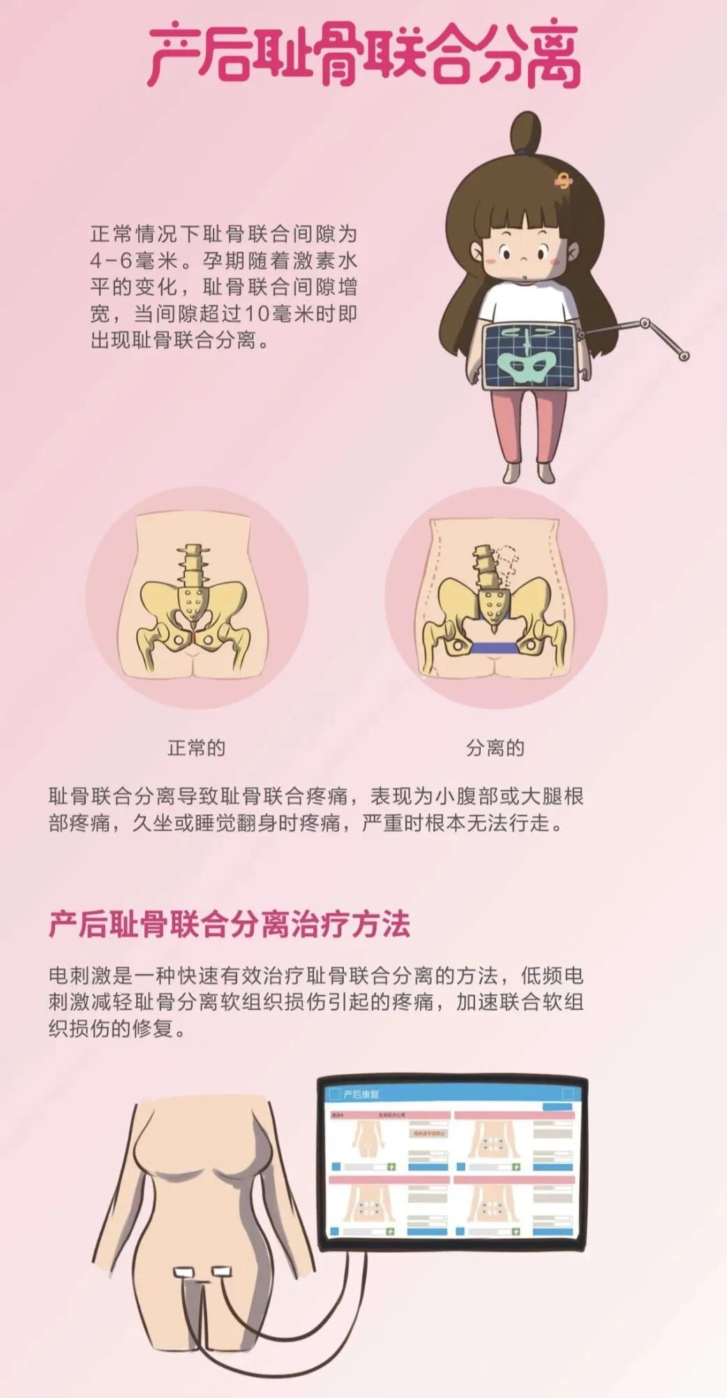 盆底肌康复治疗仪怎么用好消息！我院引进盆底肌生物反馈治疗仪——让盆底康复更轻松！_https://www.jmylbn.com_新闻资讯_第28张