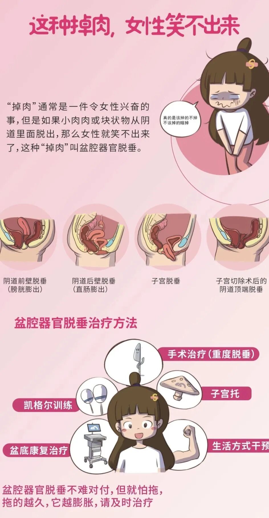 盆底肌康复治疗仪怎么用好消息！我院引进盆底肌生物反馈治疗仪——让盆底康复更轻松！_https://www.jmylbn.com_新闻资讯_第30张