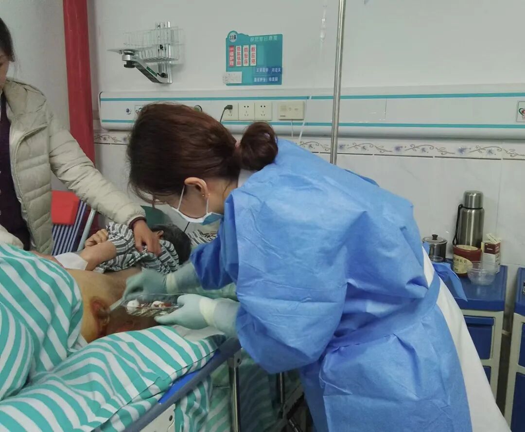 怎么促进vsd伤口愈合负压封闭引流术（VSD）：让伤口愈合更轻松_https://www.jmylbn.com_新闻资讯_第1张