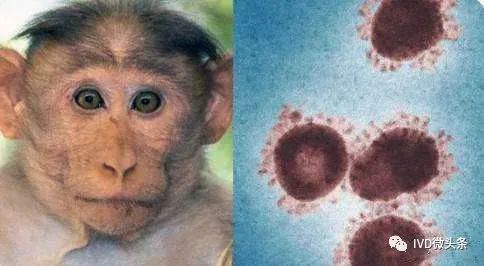 猴痘