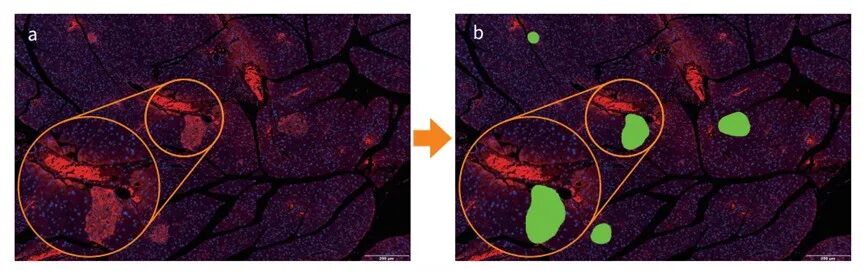超快光學層切全景掃描系統