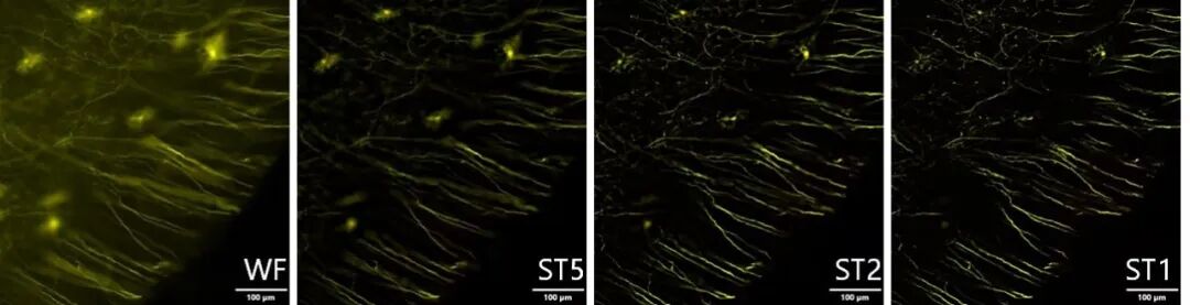 超快光學層切全景掃描系統