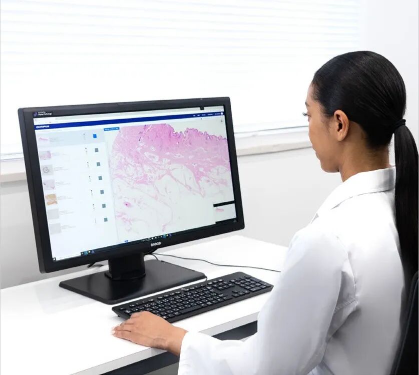 SLIDEVIEW VS-M1R全玻片掃描系統(tǒng)