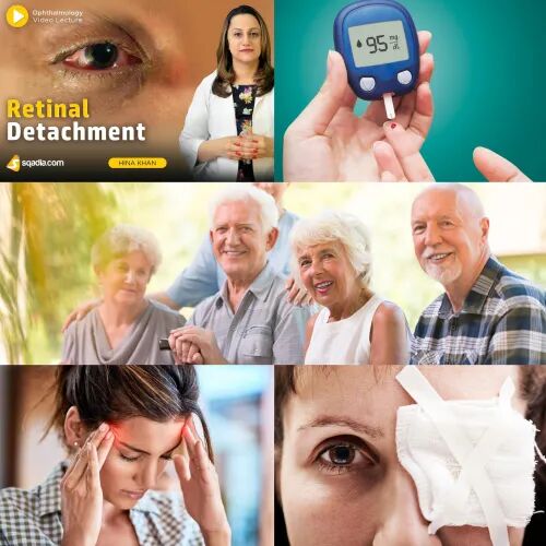 眼底照相机怎么项目介绍｜眼底照相_https://www.jmylbn.com_新闻资讯_第4张