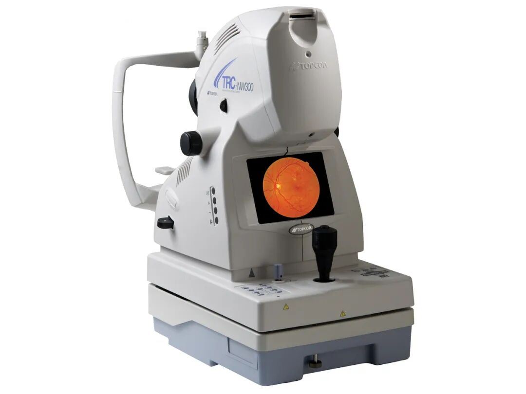 眼底照相机怎么项目介绍｜眼底照相_https://www.jmylbn.com_新闻资讯_第1张