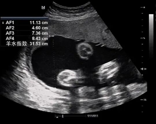 全面了解基因芯片检测，这一篇就够了