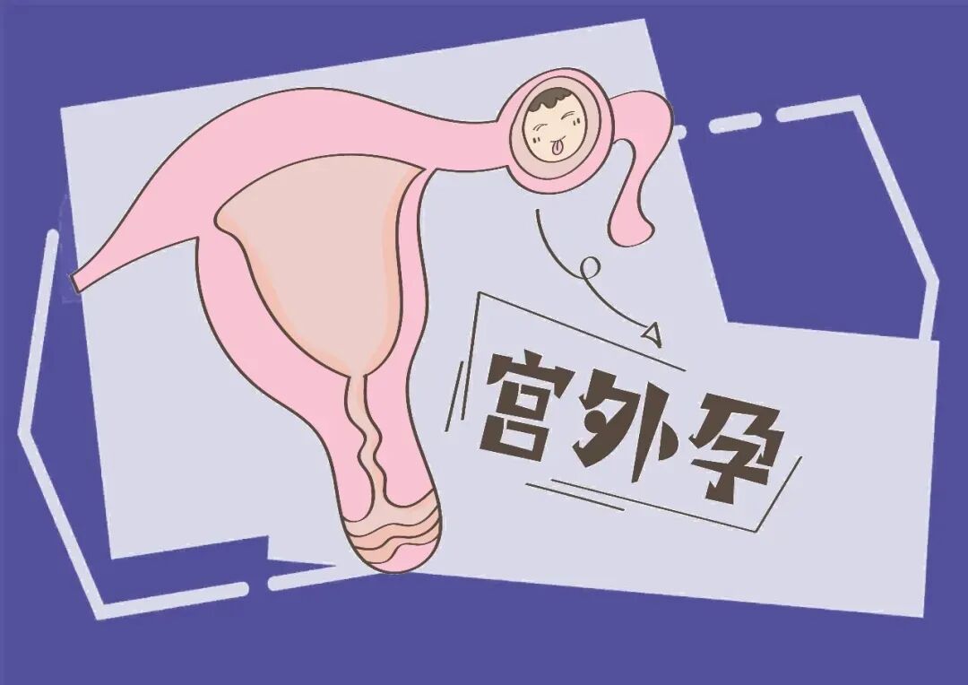 试管妊娠早期出血就一定是流产了？