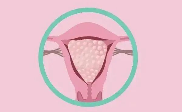 试管妊娠早期出血就一定是流产了？