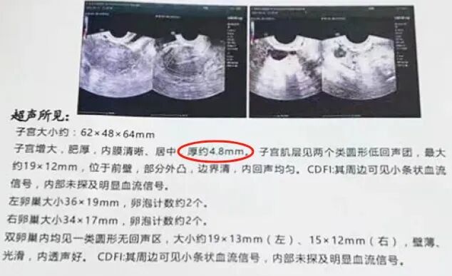 内膜薄？反复移植失败？试试这个“黑科技”！