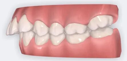 乐凯医疗怎么样矫正牙齿 重塑美丽｜乐凯医院口腔科已开展正畸治疗技术_https://www.jmylbn.com_新闻资讯_第9张