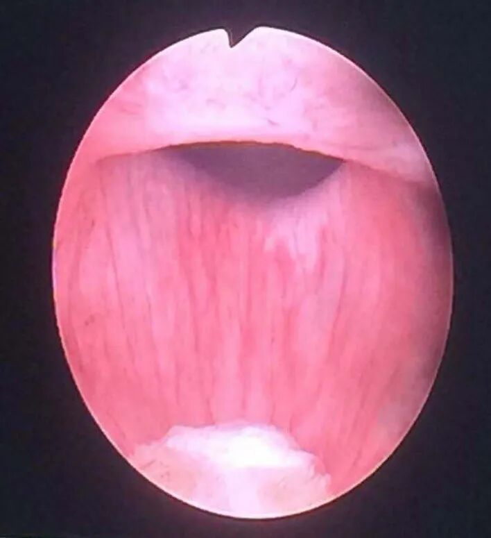 你现在所在的位置:>首页>新闻动态>医院动态>膀胱镜下所见膀胱颈口