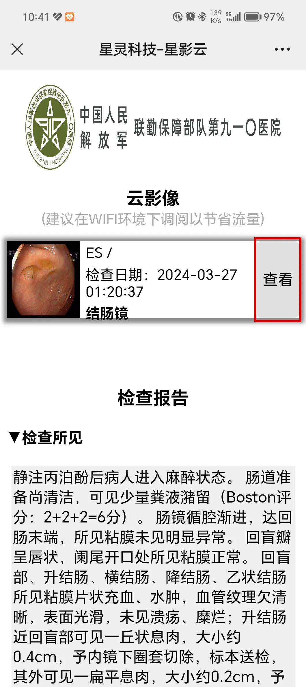 医学胶片怎么做医院【医疗资讯】他们开通了“云胶片”技术，让患者随时可以查看电子图像_https://www.jmylbn.com_新闻资讯_第10张