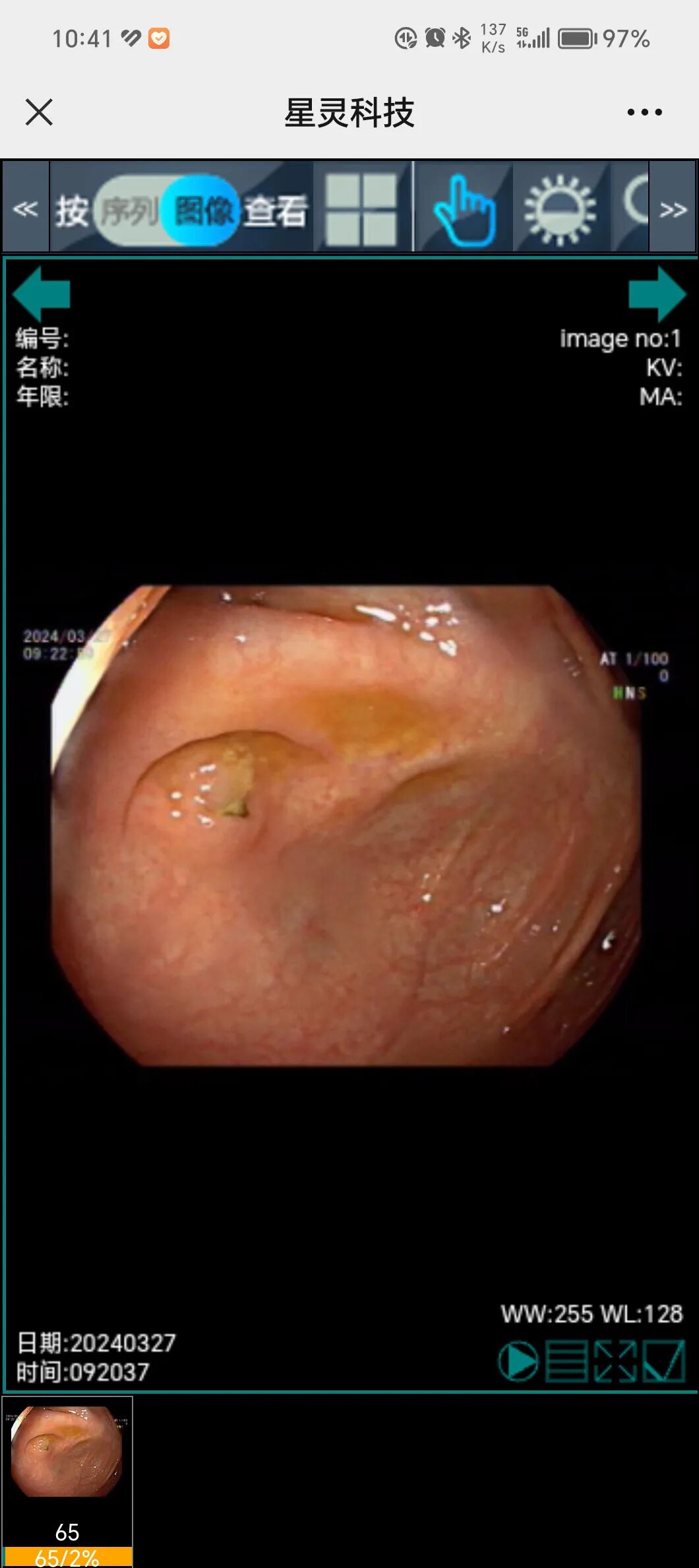 医学胶片怎么做医院【医疗资讯】他们开通了“云胶片”技术，让患者随时可以查看电子图像_https://www.jmylbn.com_新闻资讯_第11张