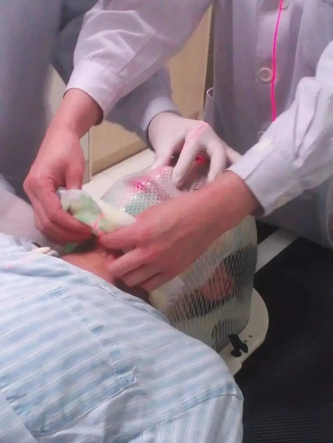 放疗体膜是什么全脑全脊髓放疗时的体位固定技巧_https://www.jmylbn.com_新闻资讯_第9张