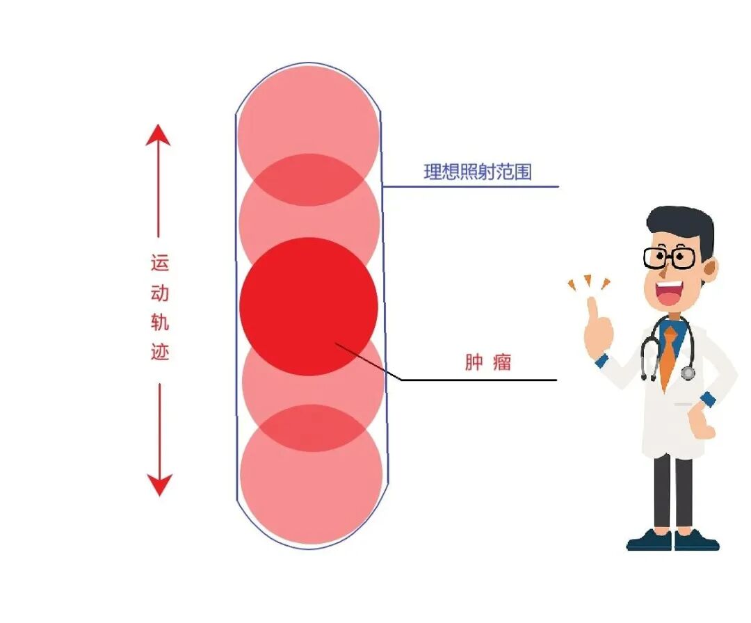 ct机器怎么分辨【科普】四维CT图像：如何助力精准放疗？_https://www.jmylbn.com_新闻资讯_第4张
