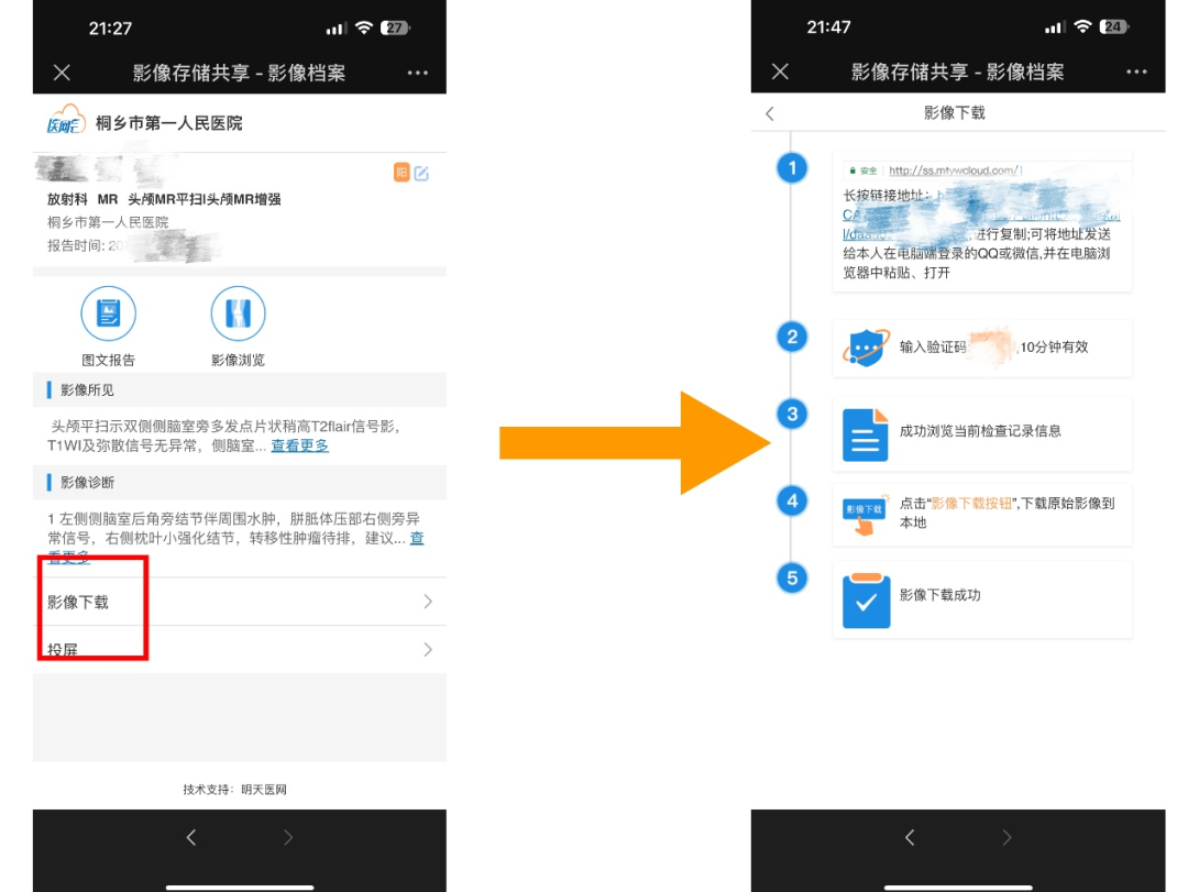 打印胶片是什么医生提醒：非必要不打印  省钱省力又省心_https://www.jmylbn.com_新闻资讯_第8张