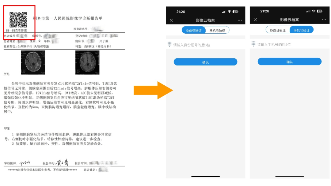 打印胶片是什么医生提醒：非必要不打印  省钱省力又省心_https://www.jmylbn.com_新闻资讯_第6张