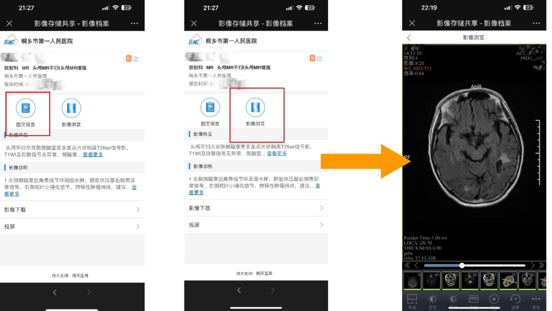 打印胶片是什么医生提醒：非必要不打印  省钱省力又省心_https://www.jmylbn.com_新闻资讯_第7张