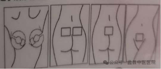 妇科脉冲怎么回事【宝妈小课堂】--产后低频脉冲电治疗_https://www.jmylbn.com_新闻资讯_第9张