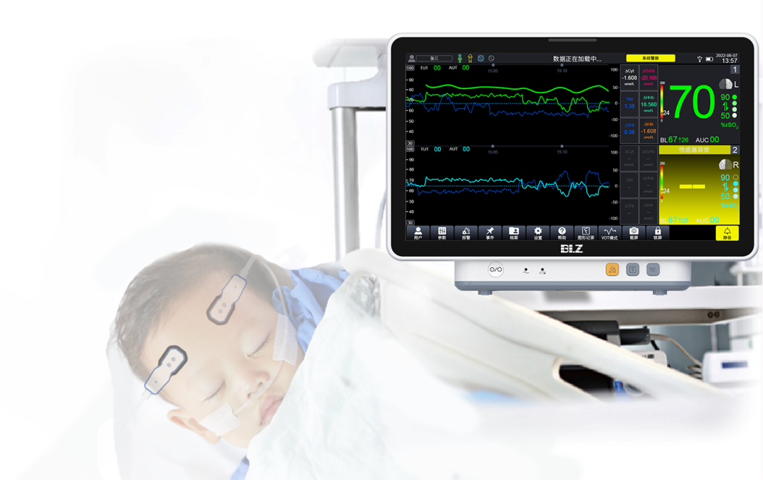 新生儿电极片怎么贴脑氧饱和度监测在小儿先天性心脏病术后的临床应用_https://www.jmylbn.com_新闻资讯_第5张