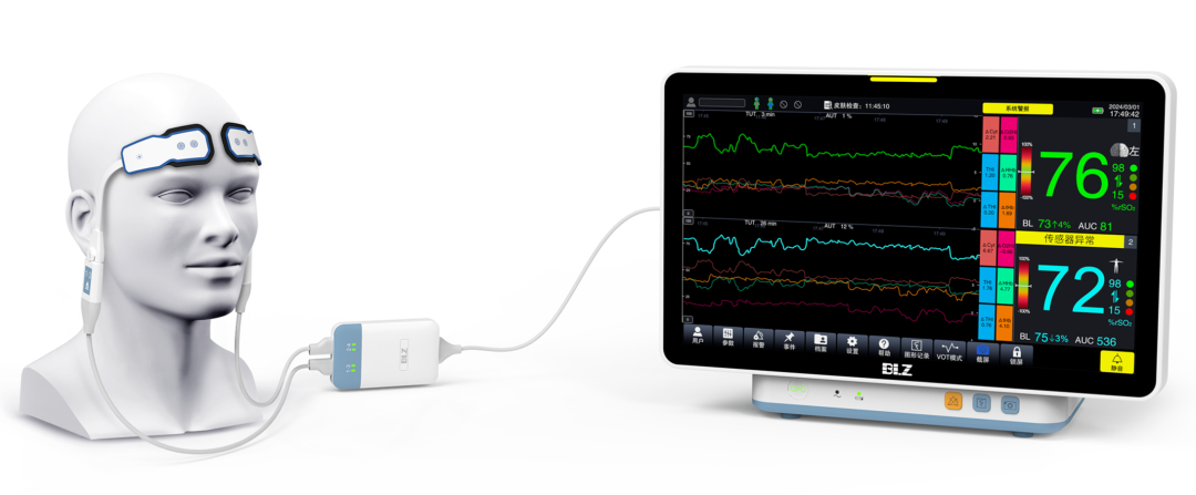 新生儿电极片怎么贴脑氧饱和度监测在小儿先天性心脏病术后的临床应用_https://www.jmylbn.com_新闻资讯_第7张