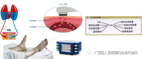 什么是经皮氧分压经皮氧分压——了解您的双足缺氧吗？_https://www.jmylbn.com_新闻资讯_第5张