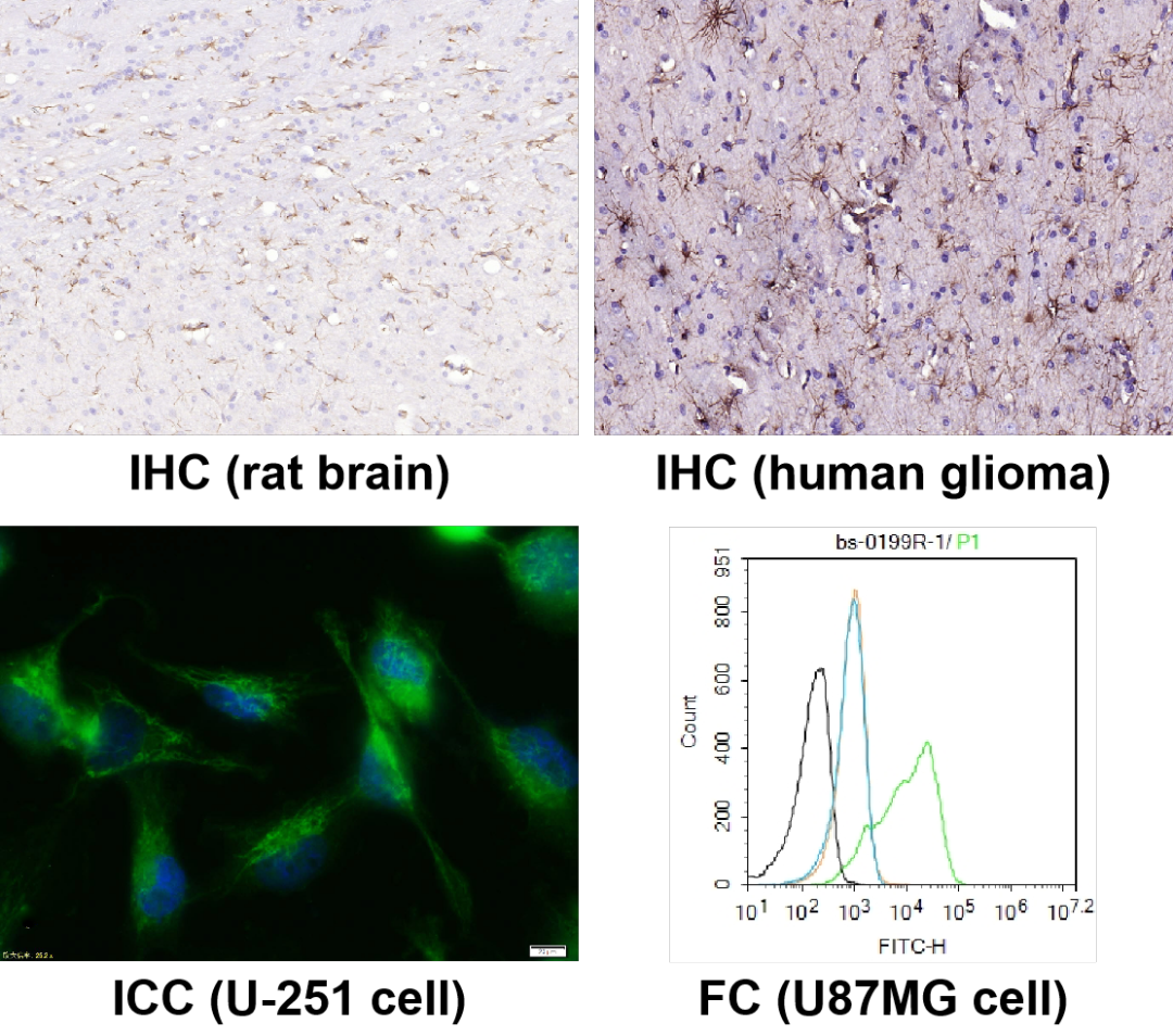 神經(jīng)細(xì)胞、神經(jīng)退行性疾病標(biāo)志物有哪些？一文速覽！
