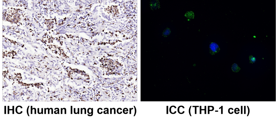 神經(jīng)細(xì)胞、神經(jīng)退行性疾病標(biāo)志物有哪些？一文速覽！