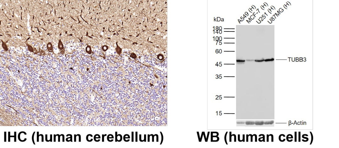 神經(jīng)細(xì)胞、神經(jīng)退行性疾病標(biāo)志物有哪些？一文速覽！