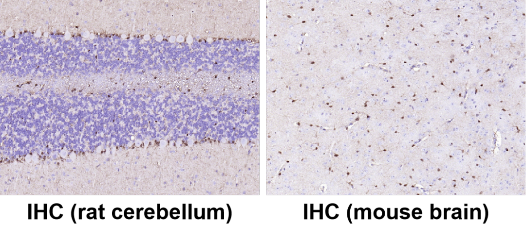 神經(jīng)細(xì)胞、神經(jīng)退行性疾病標(biāo)志物有哪些？一文速覽！