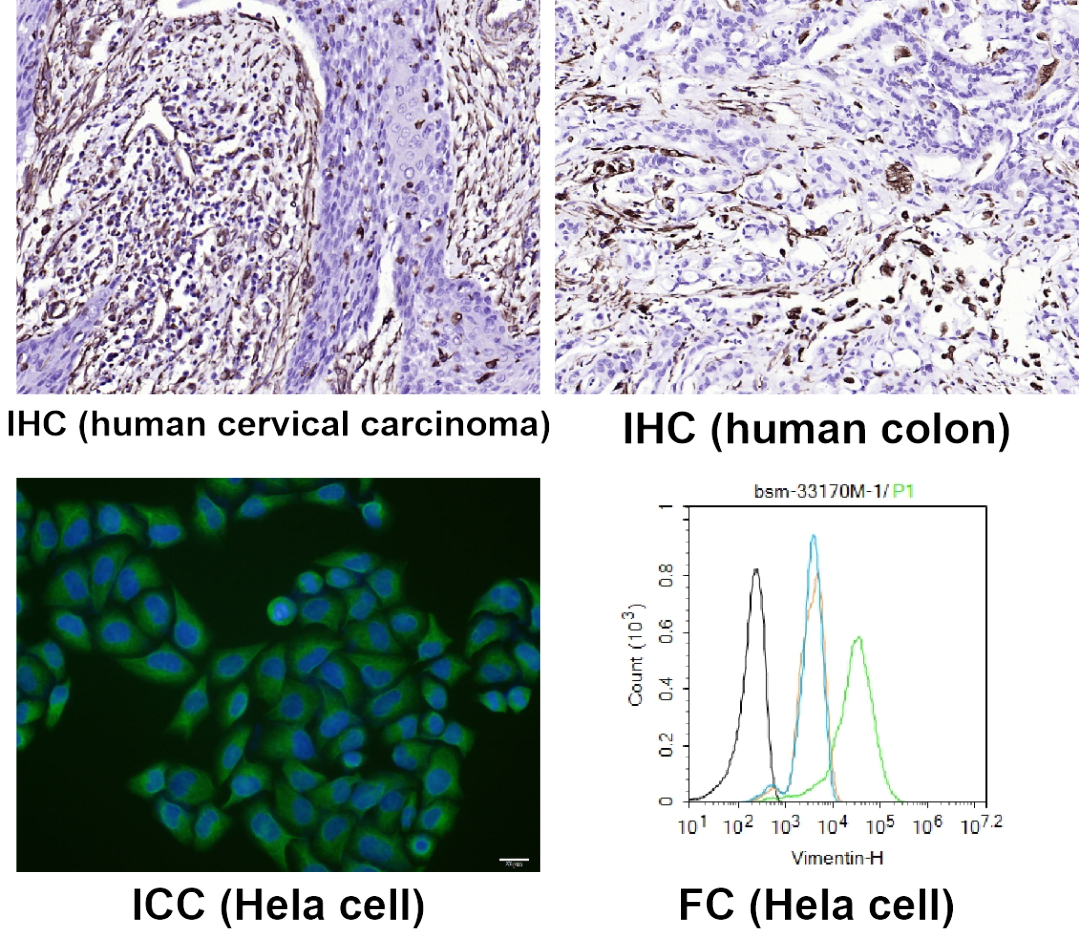 神經(jīng)細(xì)胞、神經(jīng)退行性疾病標(biāo)志物有哪些？一文速覽！