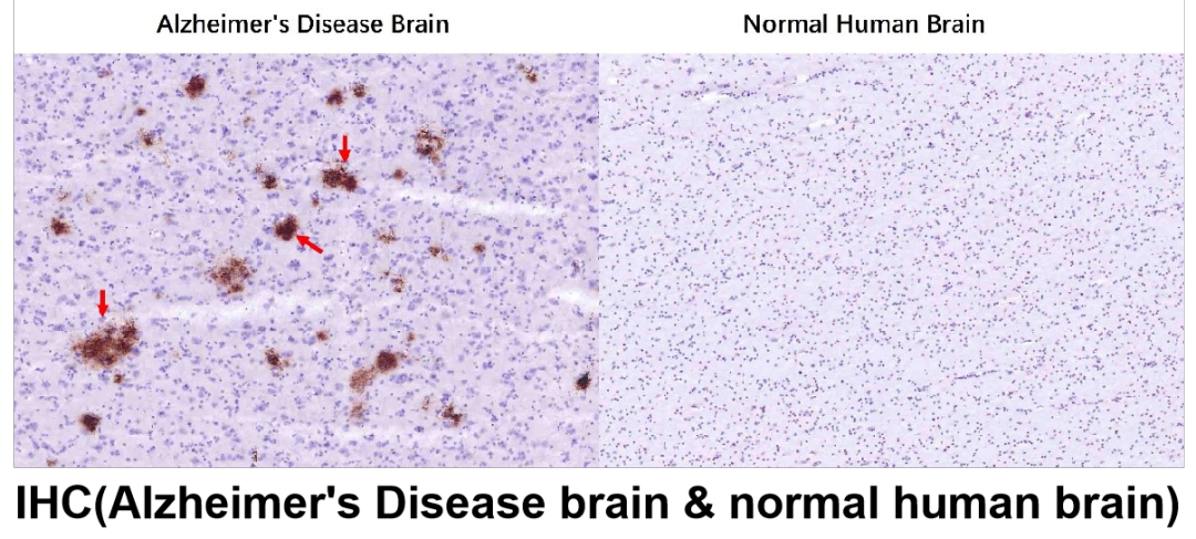 神經(jīng)細(xì)胞、神經(jīng)退行性疾病標(biāo)志物有哪些？一文速覽！