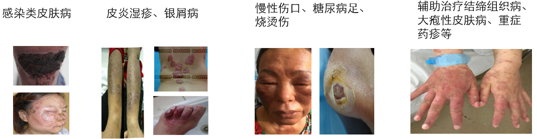 哪些单位使用水疗仪神奇的臭氧水疗，皮肤病患者的福音！_https://www.jmylbn.com_新闻资讯_第5张