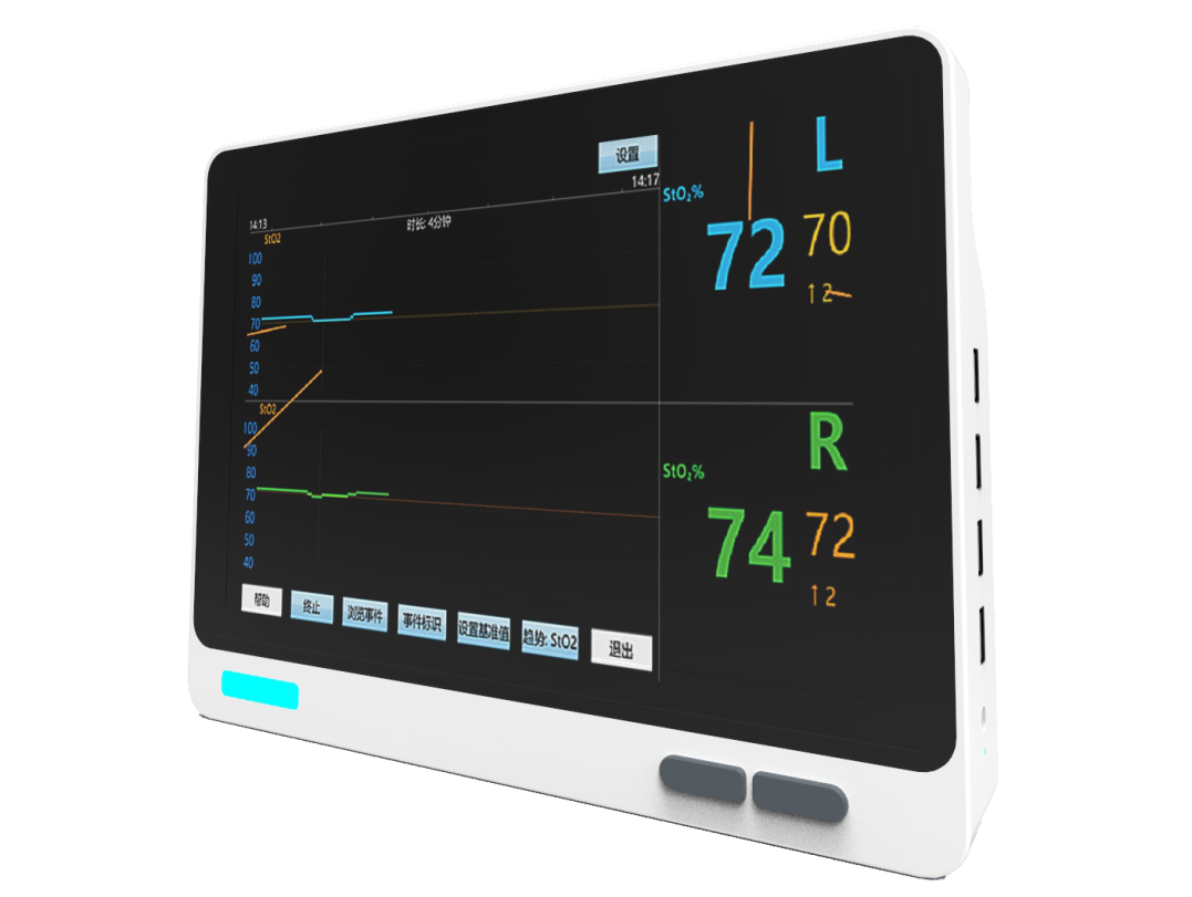 乐凡研究定制了医疗信息提升解决方案,聚焦无创脑血氧监测仪,无创动脉