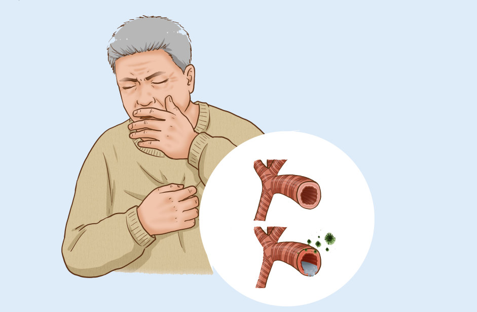 为什么要使用制氧机家中自备制氧机真的有必要吗？我该怎么选？_https://www.jmylbn.com_新闻资讯_第7张