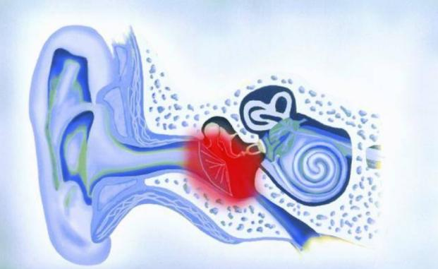 微波可以治疗什么耳鼻喉科的微波治疗到底是个啥？_https://www.jmylbn.com_新闻资讯_第14张