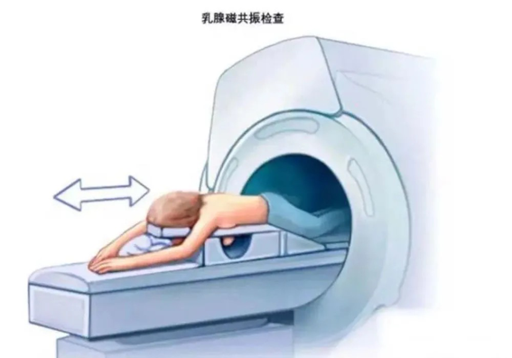 b超md是什么意思B超、拍片、磁共振？!   乳腺检查何去何从？？_https://www.jmylbn.com_新闻资讯_第4张