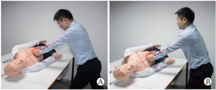 cpr按压板怎么用专家共识：腹部提压心肺复苏临床操作指南_https://www.jmylbn.com_新闻资讯_第10张