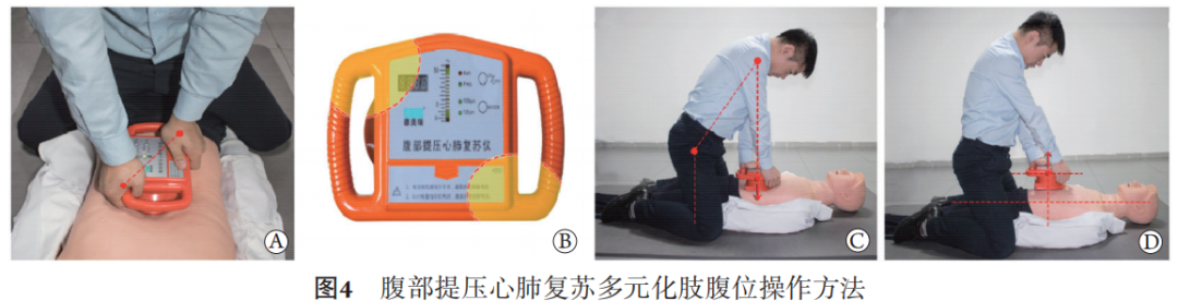 cpr按压板怎么用专家共识：腹部提压心肺复苏临床操作指南_https://www.jmylbn.com_新闻资讯_第7张