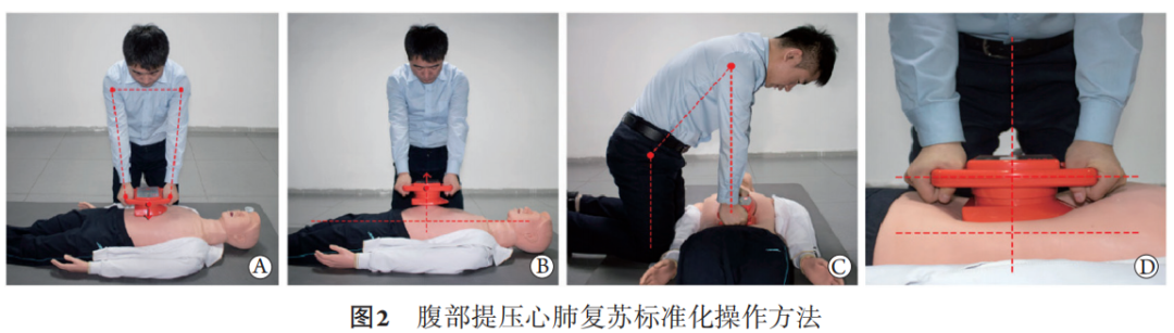 cpr按压板怎么用专家共识：腹部提压心肺复苏临床操作指南_https://www.jmylbn.com_新闻资讯_第5张