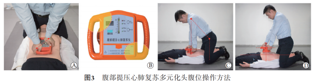 cpr按压板怎么用专家共识：腹部提压心肺复苏临床操作指南_https://www.jmylbn.com_新闻资讯_第6张