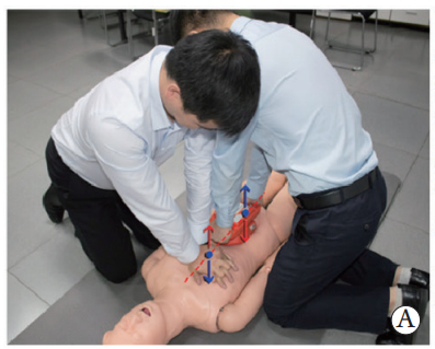 cpr按压板怎么用专家共识：腹部提压心肺复苏临床操作指南_https://www.jmylbn.com_新闻资讯_第8张