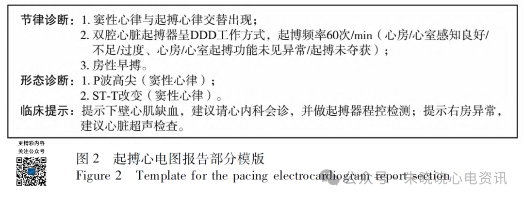 心电图报告规范化书写专家共识(2026
