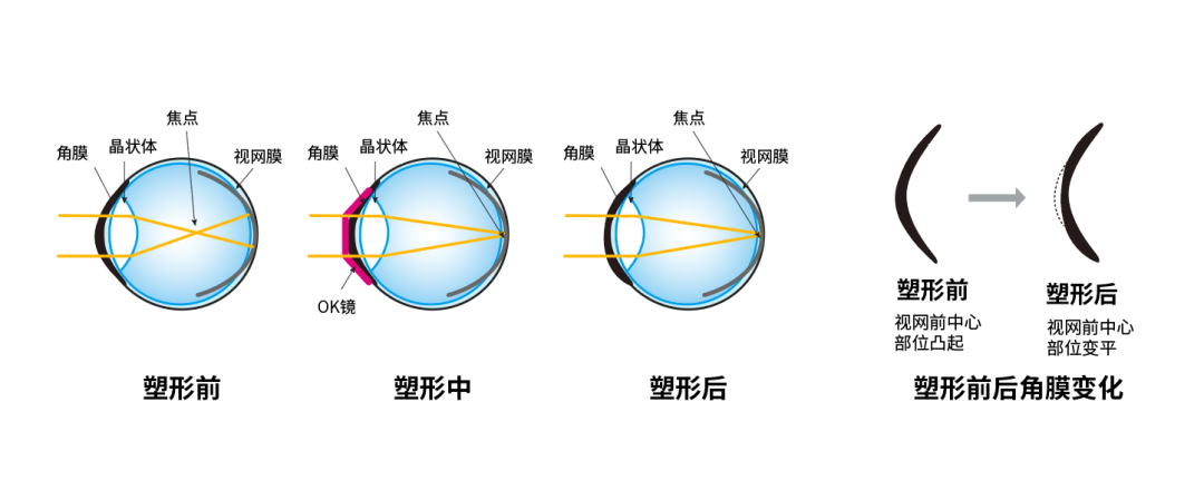 ok镜的原理图片