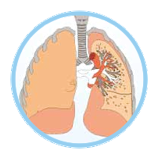 为什么要用静脉营养袋“全静脉营养治疗”知多少_https://www.jmylbn.com_新闻资讯_第12张