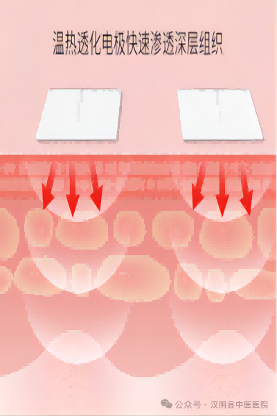 透药有什么作用妇科绿色疗法——中医定向透药治疗_https://www.jmylbn.com_新闻资讯_第1张