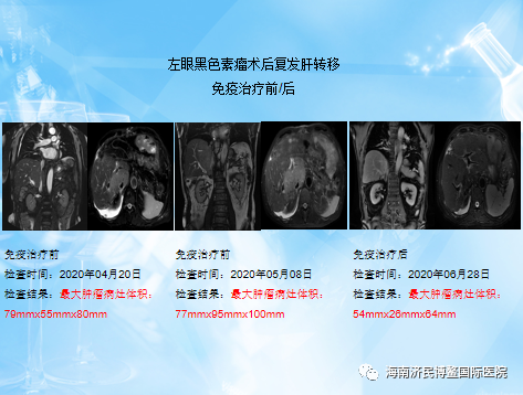博鳌国际医院创造生命奇迹，晚期恶性黑色素瘤患者送旗感恩插图6