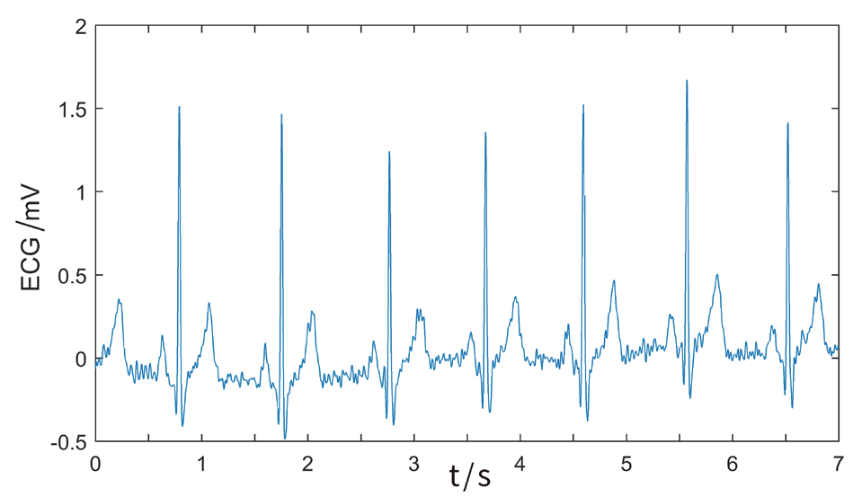 基于STM32的多功能心电信号监测系统设计的图9